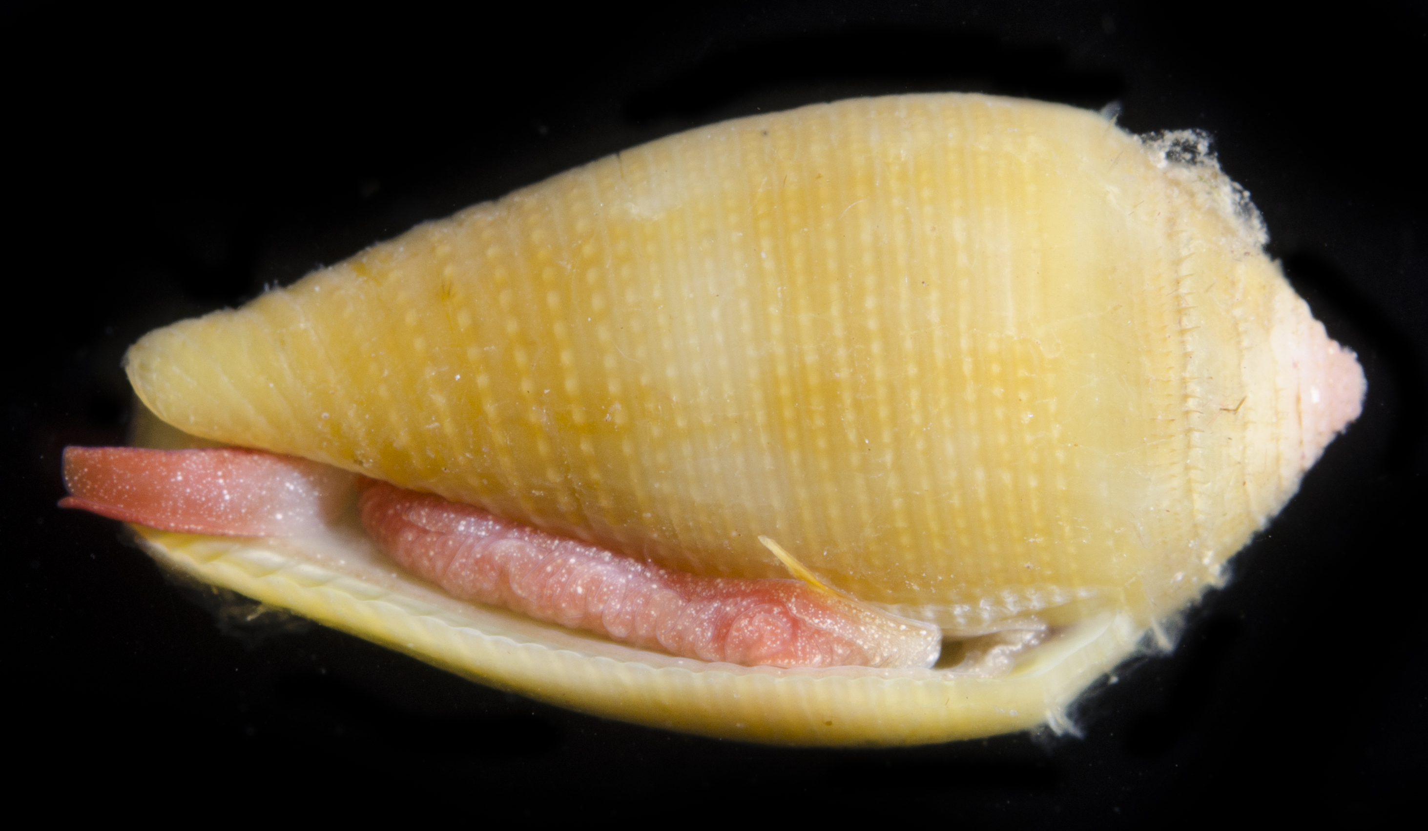 Pterygia